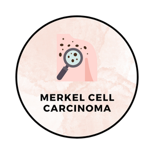 Merkel Cell Carcinoma
