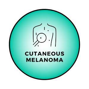 Cutaneous Melanoma
